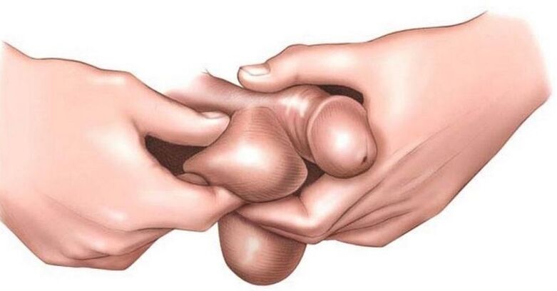 なぜ卵は男性にかゆみがあるのですか